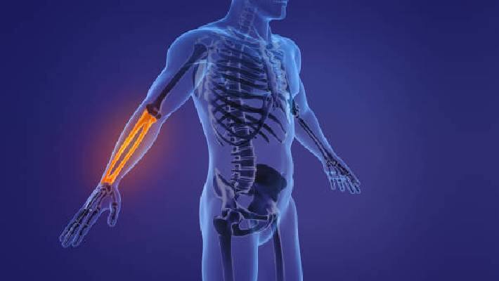 strengthens bones
