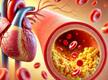 how to reduce bad cholesterol with home remedy in tamil mks