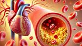 how to reduce bad cholesterol with home remedy in tamil mks