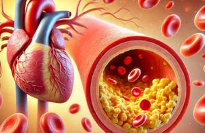how to reduce bad cholesterol with home remedy in tamil mks