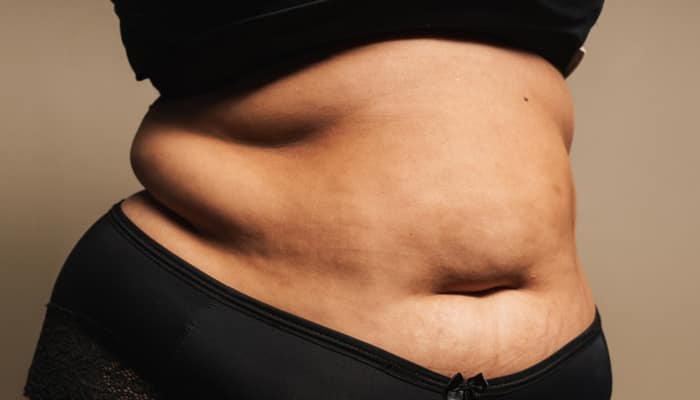 Avoid These Foods During Menopause To Manage Excess Belly Fat