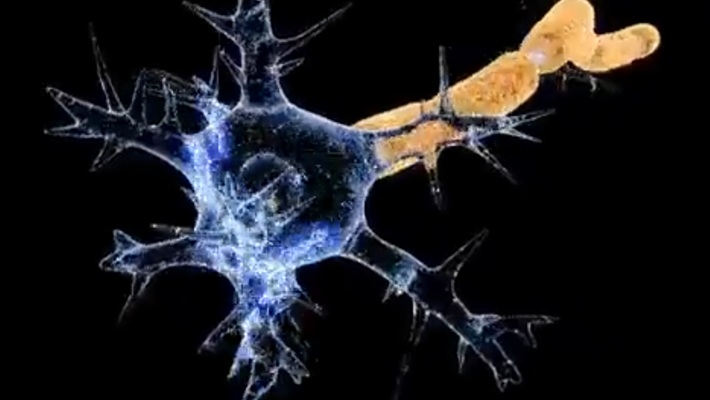 Guillain Barre Syndrome  Guillain Barre Syndrome