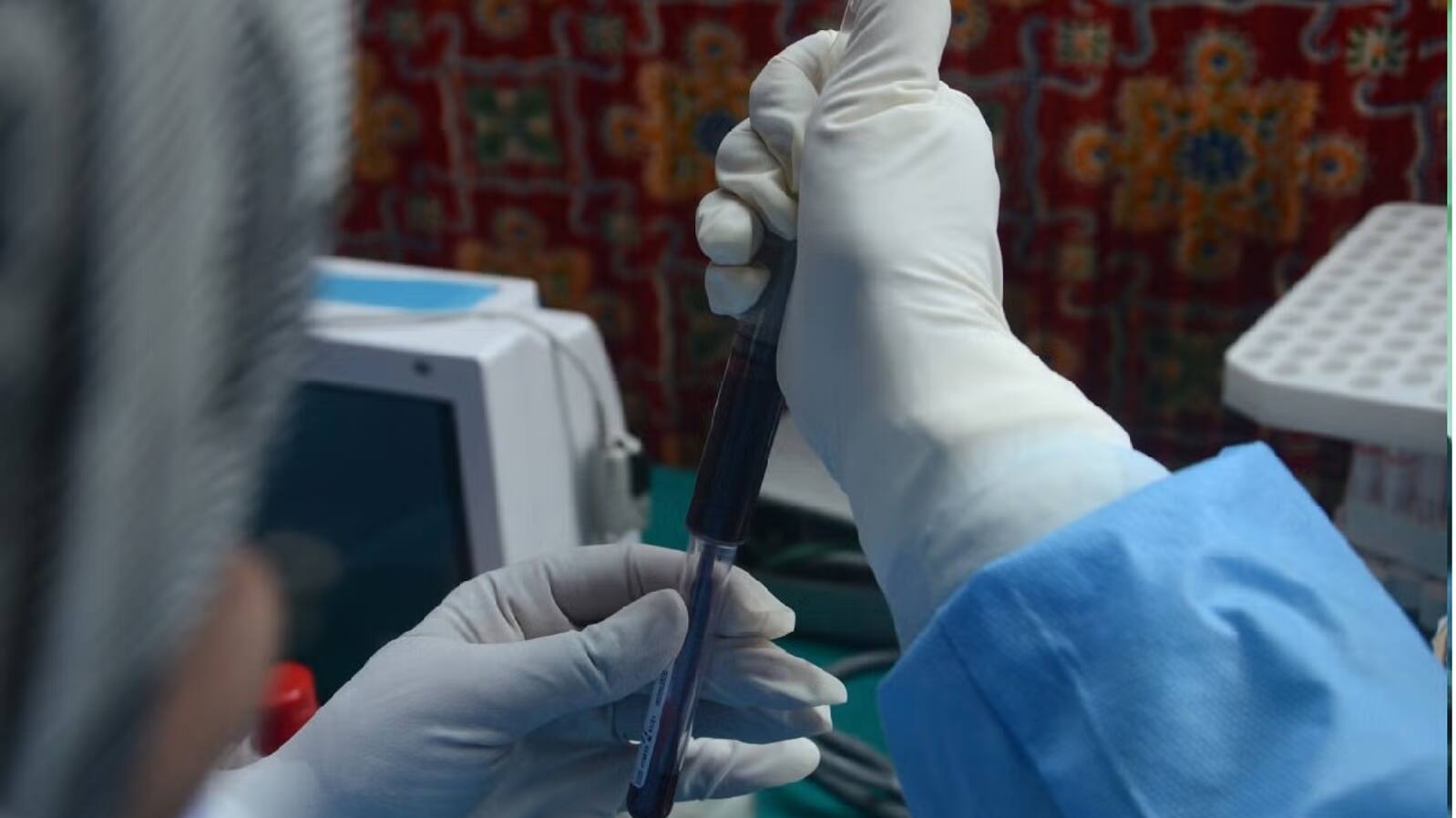  Guillain Barre Syndrome
