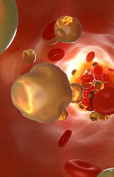 reasons for bad cholesterol to increase