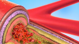 Foods That Increase Bad Cholesterol
