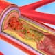these foods may increase cholesterol