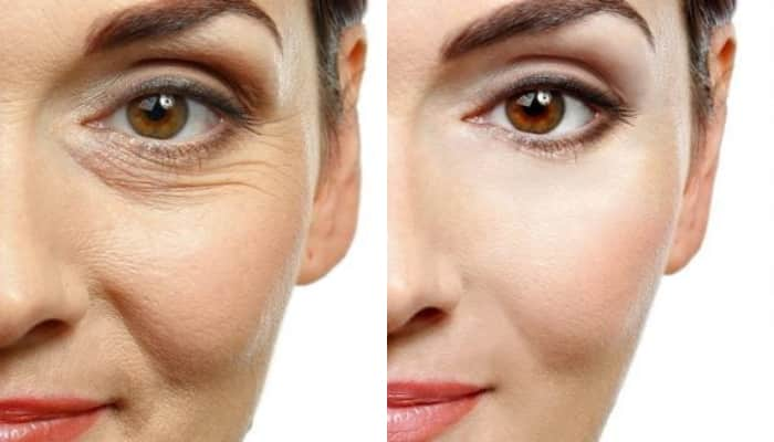 Considering Botox?  Foods That Can Do Wonders For Ageing