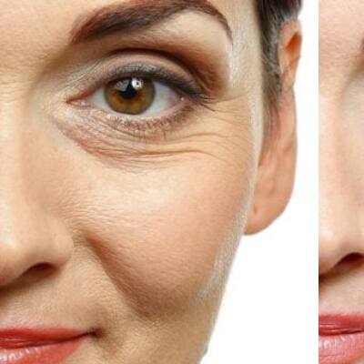 Face Glow: ఇవి రాస్తే.. మీ ముఖంపై ముడతలు తగ్గి, యవ్వనంగా మెరిసిపోతారు..!
