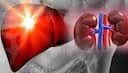 Health: ఉద‌యం బ్రేక్‌ఫాస్ట్‌లో ఇవి తీసుకుంటున్నారా? లివ‌ర్ డ్యామేజ్ కావ‌డం ఖాయం