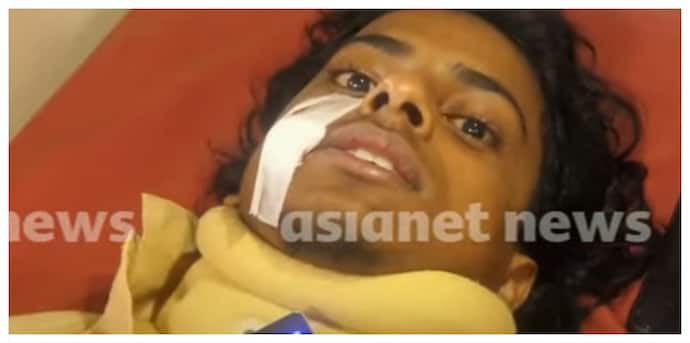 Kerala: Cheek stabbed with key, teeth broken; Student brutally assaulted by seniors over Instagram post