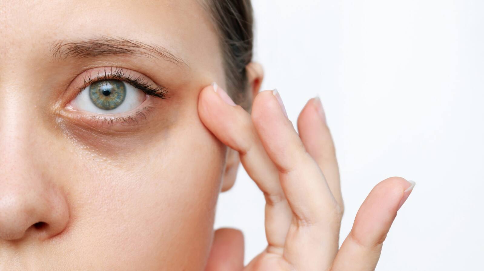 Dark circle under eye