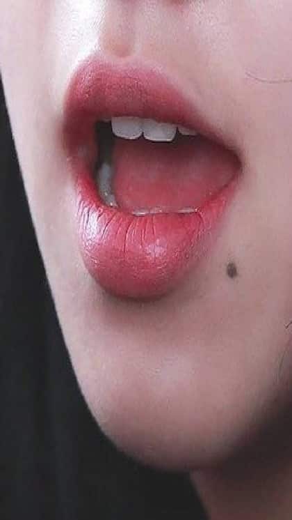 కుడి చెంపపై మచ్చ