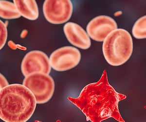 Do you know what juices to drink to cure anemia? mma