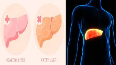 Liver Diet: లివర్ ఆరోగ్యాన్ని మెరుగుపరిచే అద్భుతమైన వంట నూనెలు ఇవే..!
