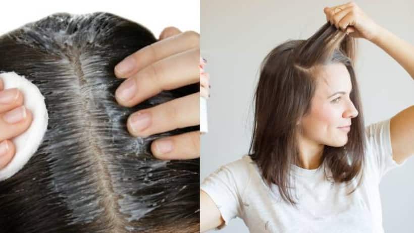 Smelly Hair జుట్టు నుంచి దుర్వాసన.. ఇలా చేస్తే గాయబ్!