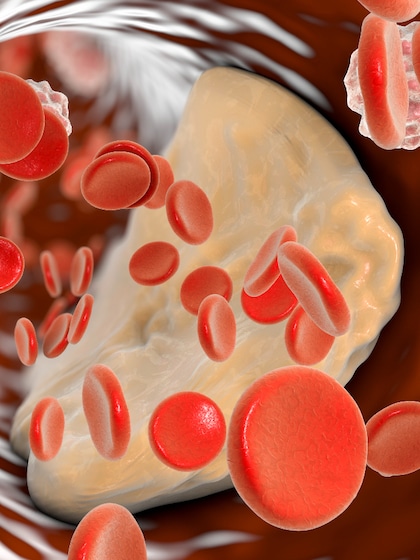 Health: చెడు కొలెస్ట్రాల్‌ తగ్గాలంటే..ఈ సూపర్‌ ఫుడ్స్‌ని ఫాలోకండి!