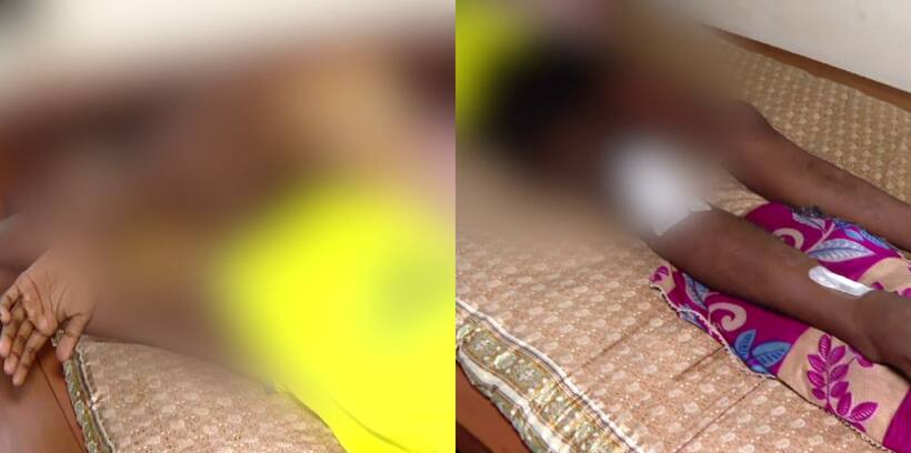 Violent incidents on rise in Kerala as Class 9 student suffers broken leg after being attacked by seniors