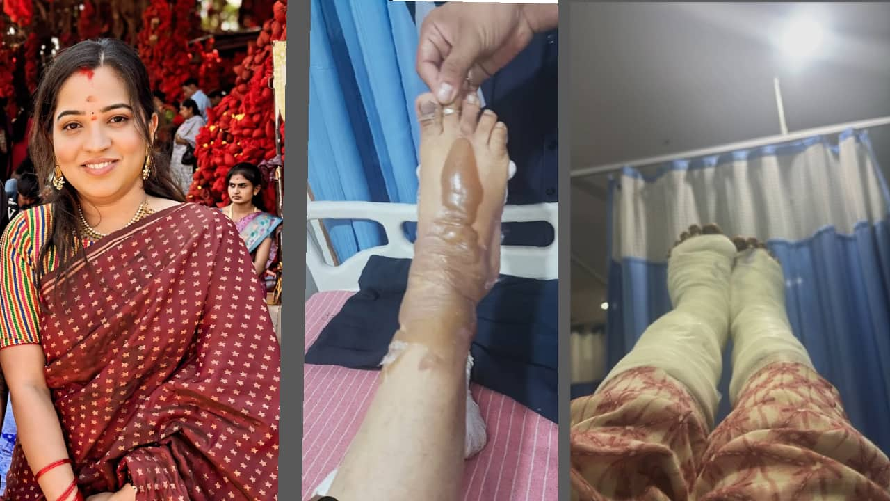 actor anchor master anand wife yashaswini leg injury video viral 