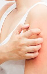 Summer Itch Relief Home Remedies Heat Rash Treatment rav