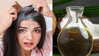 White Hair: సోంపు నూనె వాడితే తెల్ల జుట్టు శాశ్వతంగా నల్లగా అవ్వాల్సిందే..!