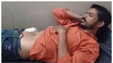 Abdominal pain unbearable young UP man who operated on himself after watching YouTube in hospital 11 stitches Abdominal pain unbearable young UP man who operated on himself after watching YouTube in hospital 11 stitches