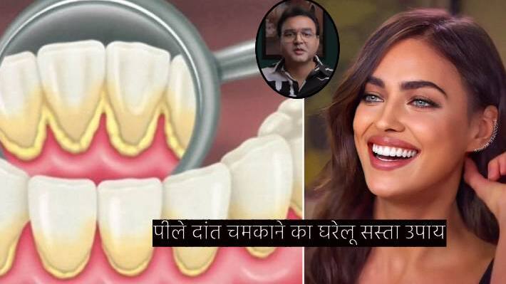 Home remedies to brighten yellow teeth by dr Saleem zaidi