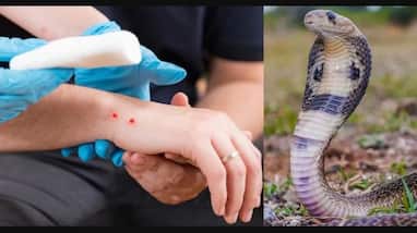 What to do after snake bite BSV releases precautionary measures guidelines sat What to do after snake bite BSV releases precautionary measures guidelines sat