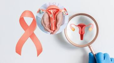 Women cancer risk intimacy positions lifestyle study Women cancer risk intimacy positions lifestyle study