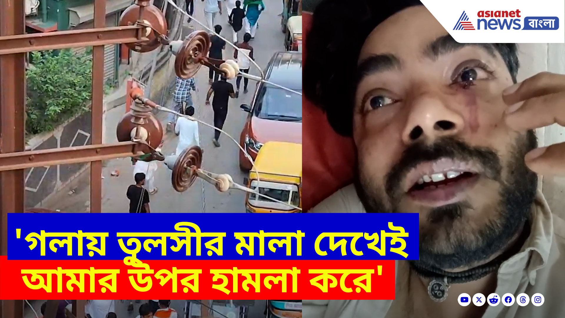 Baruipur Clash: 'গলায় তুলসীর মালা দেখেই আমার উপর হামলা করে', এ কী বলছেন বারুইপুরে মুসলিমদের হাতে আক্রান্ত হিন্দু?