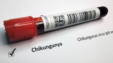 chikungunya alert symptoms of chikungunya chikungunya alert symptoms of chikungunya