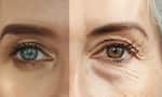 Anti Aging Drinks For Youthful Skin in telugu KVG
