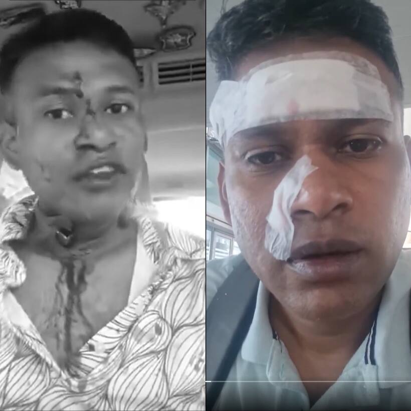 Bengaluru road rage shocker: IAF officer assaulted, shares 'you can see the blood' ordeal (WATCH)
