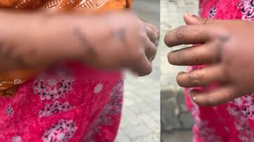former drug peddler leave drug syndicate allegedly face life threat and attacked in kozhikode 24 April 2025 former drug peddler leave drug syndicate allegedly face life threat and attacked in kozhikode 24 April 2025