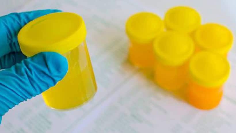 urine therapy