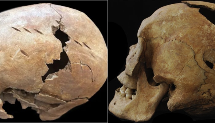 3700 year old cemetery in China show evidence of extreme violence and Overkill