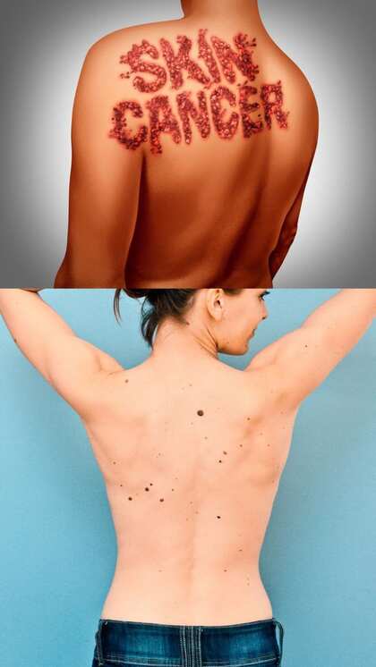Sunlight and Beauty Products: Skin Cancer Risks