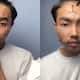 Youth Develops Painful Skin Disease After Wearing Unwashed Thrifted Clothes video goes viral
