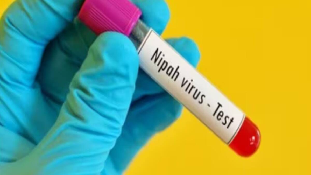 Nipah Virus