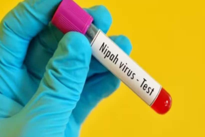 Nipah Virus