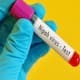 nipah virus alert malappuram latest updates 
