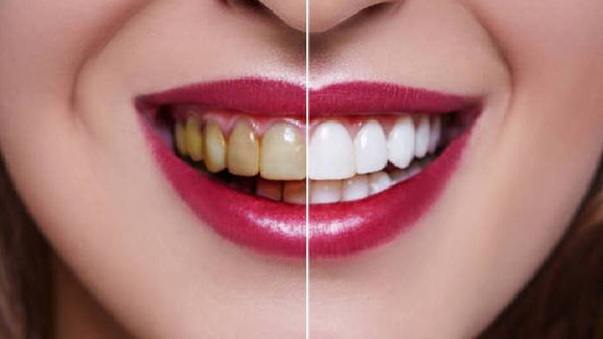 teeth
