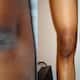homemade beauty tips for dark knees and elbows in telugu ram