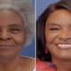 plastic surgeon gives one crores face lift surgery to mom Linda Truesdale