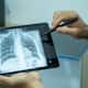 Peanut stuck three year olds lung found in x ray