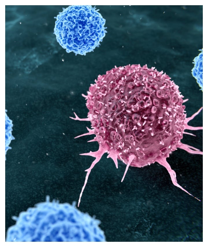 this diet can reduce the risk of cancer study