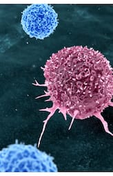 this diet can reduce the risk of cancer study