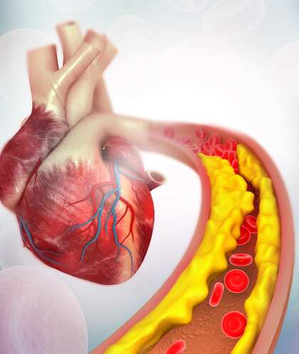 Cholesterol: కొలెస్ట్రాల్‌కు కళ్లెం వేయాలంటే.. ఈ ఆహారం తినాల్సిందే !