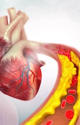 vegetarian foods that lower bad cholesterol levels naturally