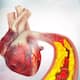 vegetarian foods that lower bad cholesterol levels naturally