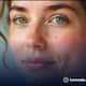 Pimples and Internal Health What Your Acne Reveals ram 